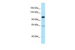 SMC6L1 Rabbit anti-Human, Polyclonal, Novus Biologicals 100 &mu;g; Unconjugated:Antibodies,